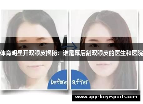 体育明星开双眼皮揭秘：谁是幕后割双眼皮的医生和医院